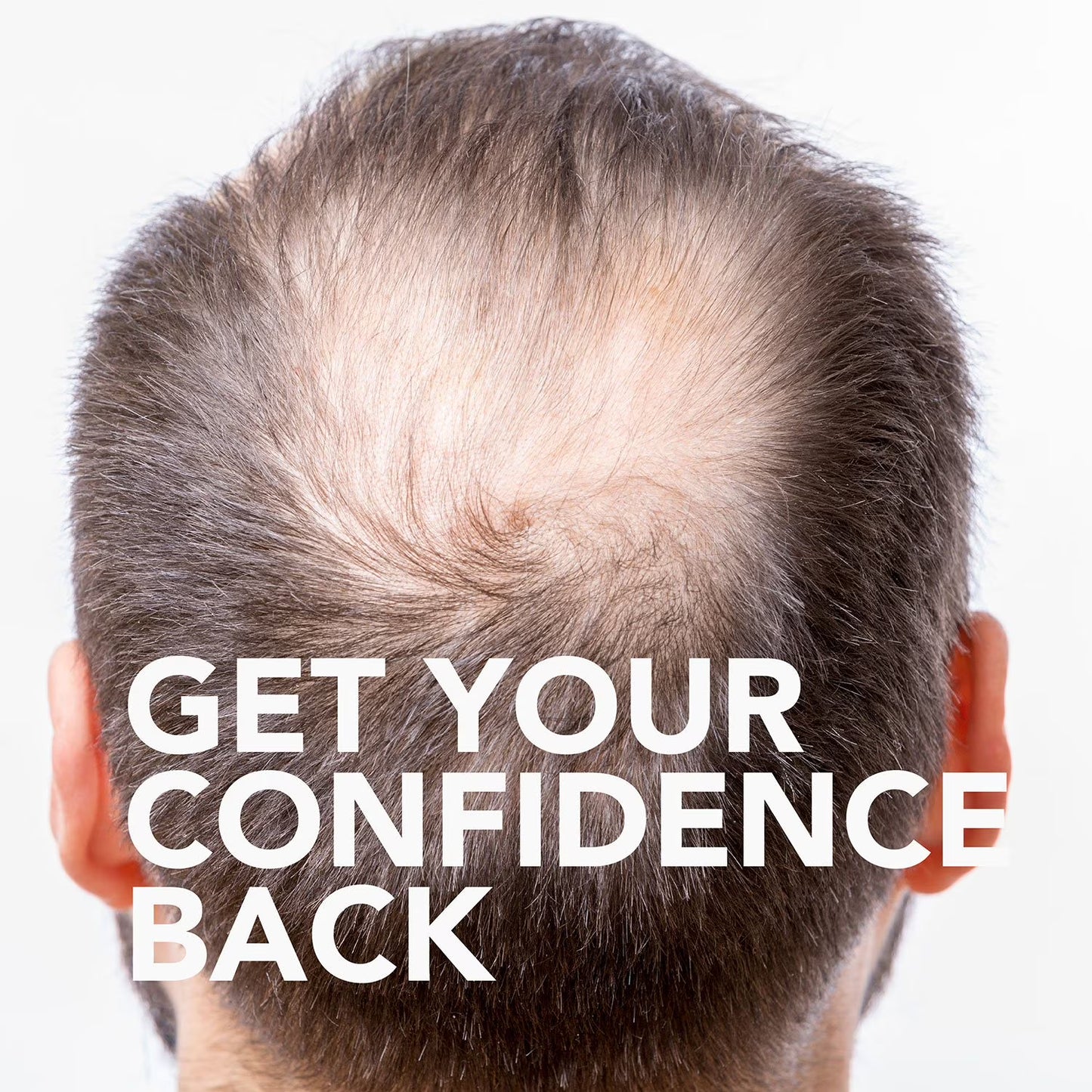 6 months Member's Mark Minoxidil 5%, Hair Regrowth Treatment for Men